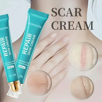 NEYEROS® Crème réparatrice de cicatrices - Réparation puissante, sans laisser de traces