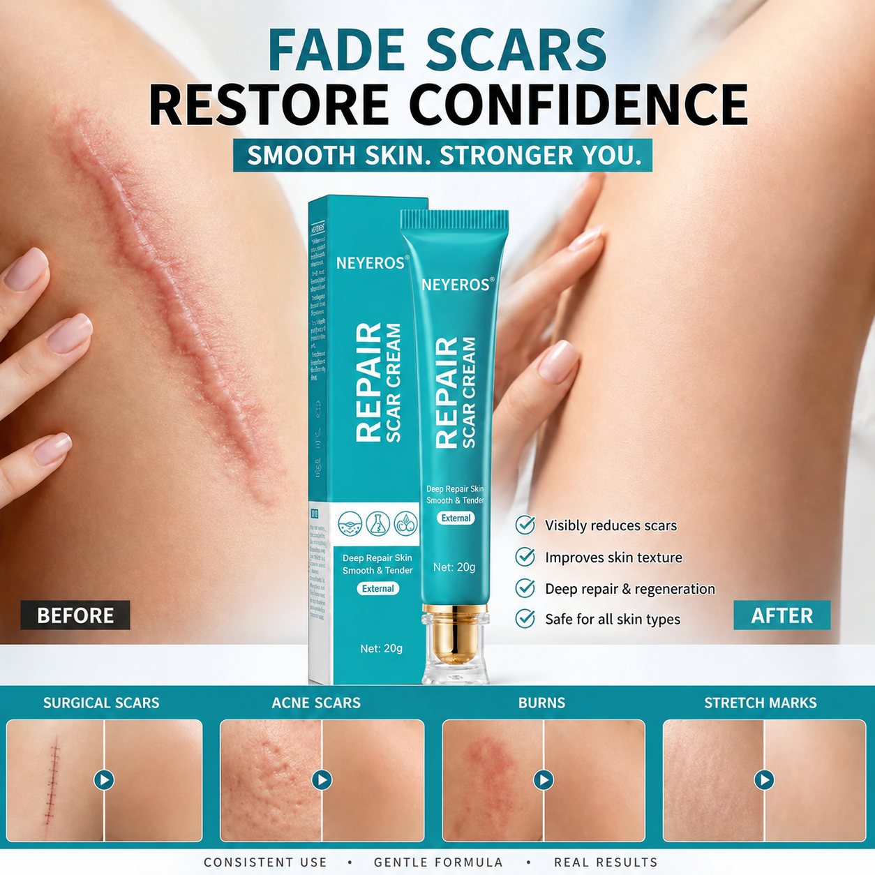 NEYEROS® Crème réparatrice de cicatrices - Réparation puissante, sans laisser de traces